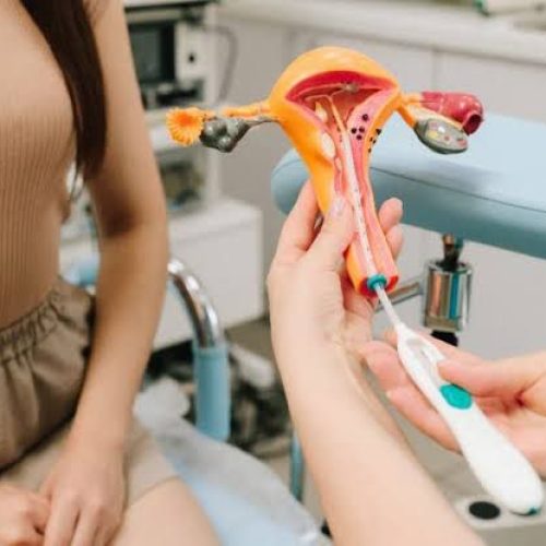 Goiás promove mutirão para inserção gratuita de DIU e amplia acesso a contraceptivos pelo SUS