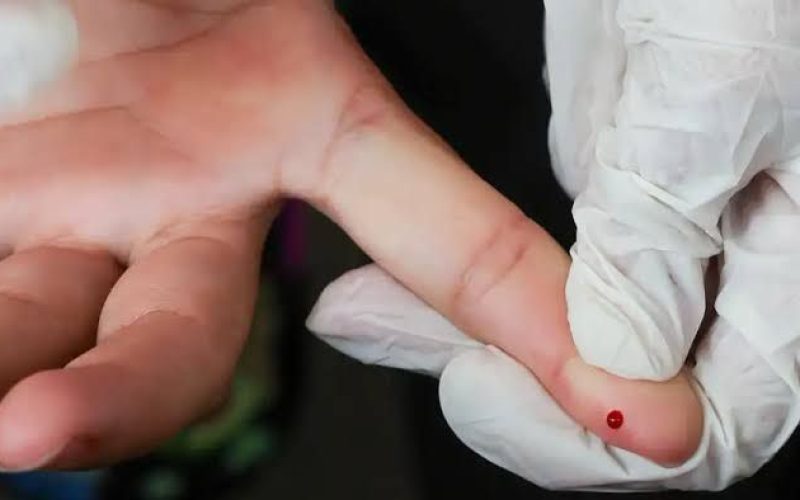 Ministério da Saúde inclui testes rápidos no SUS para ampliar diagnóstico e controle da dengue no Brasil