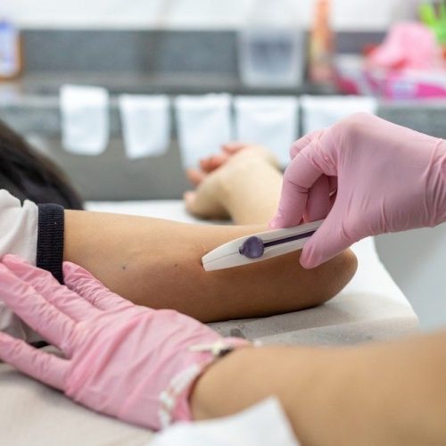 Acesso gratuito ao Implanon será oferecido pelo SUS neste fim de semana